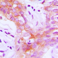 IGF1 Receptor (Phospho-Y1161) Rabbit Polyclonal Antibody