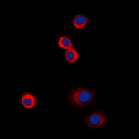 IGF1 Receptor (Phospho-Y1161) Rabbit Polyclonal Antibody