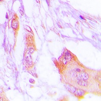 MARK Rabbit Polyclonal Antibody