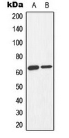 AMPK alpha 1/2 (Phospho-T183/172) Rabbit Polyclonal Antibody