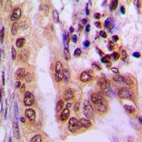 AMPK alpha 1/2 (Phospho-T183/172) Rabbit Polyclonal Antibody