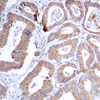 MKK1/2 (Phospho-S218/222) Rabbit Polyclonal Antibody