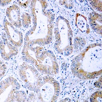 MKK1/2 (Phospho-S222/226) Rabbit Polyclonal Antibody