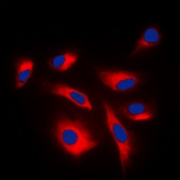 MKK1/2 (Phospho-S222/226) Rabbit Polyclonal Antibody