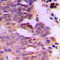 SIAH1/2 Rabbit Polyclonal Antibody