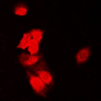 SIAH1/2 Rabbit Polyclonal Antibody
