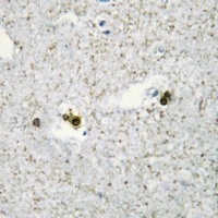 SP3/4 Rabbit Polyclonal Antibody
