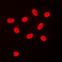 SP3/4 Rabbit Polyclonal Antibody