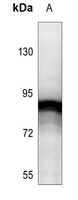 STAT5 (Phospho-Y694/699) Rabbit Polyclonal Antibody