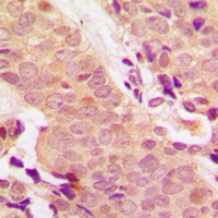 STAT5 (Phospho-Y694/699) Rabbit Polyclonal Antibody