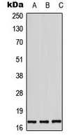 Histone H3 (Phospho-T11) Rabbit Polyclonal Antibody