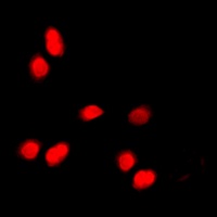 Histone H3 (Phospho-T11) Rabbit Polyclonal Antibody