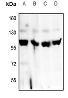 Factor B Rabbit Polyclonal Antibody