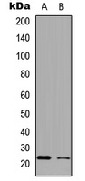 APOBEC3C Rabbit Polyclonal Antibody