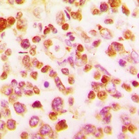 BCL6 Rabbit Polyclonal Antibody