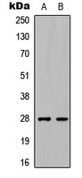 C1QL3 Rabbit Polyclonal Antibody