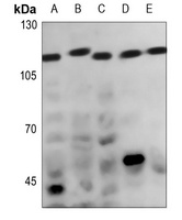 CATSPER1 Rabbit Polyclonal Antibody