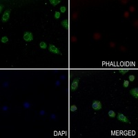 CATSPER1 Rabbit Polyclonal Antibody