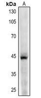 CD123 Rabbit Polyclonal Antibody