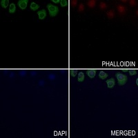 CD123 Rabbit Polyclonal Antibody