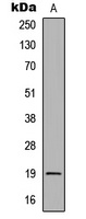 CD268 Rabbit Polyclonal Antibody