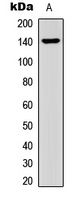 Collagen 15 alpha 1 Rabbit Polyclonal Antibody