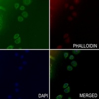 Collagen 15 alpha 1 Rabbit Polyclonal Antibody