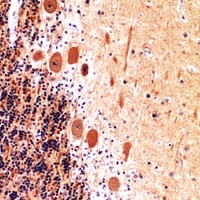 Collagen 5 alpha 2 Rabbit Polyclonal Antibody
