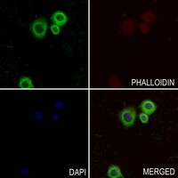 Collagen 5 alpha 2 Rabbit Polyclonal Antibody
