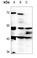 DMRTA1 Rabbit Polyclonal Antibody