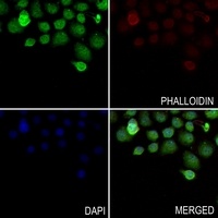 DMRTA1 Rabbit Polyclonal Antibody