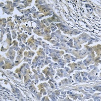 DnaJC3 Rabbit Polyclonal Antibody