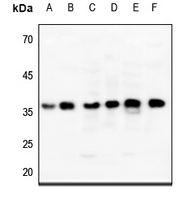 ENT2 Rabbit Polyclonal Antibody