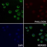 ENT2 Rabbit Polyclonal Antibody