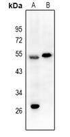 EPX HC Rabbit Polyclonal Antibody