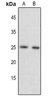 FGF17 Rabbit Polyclonal Antibody