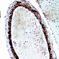 FGF17 Rabbit Polyclonal Antibody