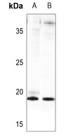 FGF4 Rabbit Polyclonal Antibody