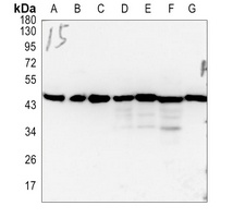 FoxD4L5 Rabbit Polyclonal Antibody