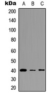 FPR3 Rabbit Polyclonal Antibody