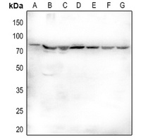 Fractalkine Rabbit Polyclonal Antibody