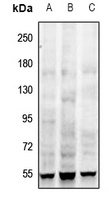 Frizzled 4 Rabbit Polyclonal Antibody