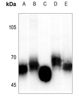 GGT5 HC Rabbit Polyclonal Antibody