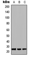 GH1 Rabbit Polyclonal Antibody