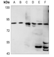 HSD17B4 Rabbit Polyclonal Antibody