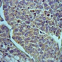 HSD17B4 Rabbit Polyclonal Antibody