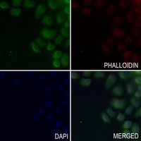 IL-20RA Rabbit Polyclonal Antibody