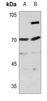 ITIH4 70k Rabbit Polyclonal Antibody