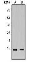KCNE1L Rabbit Polyclonal Antibody