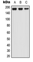 LTBP1 Rabbit Polyclonal Antibody